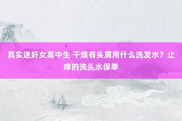 真实迷奸女高中生 干燥有头屑用什么洗发水？止痒的洗头水保举